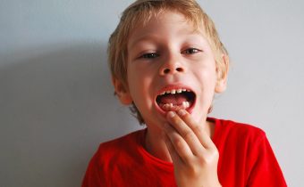Cariile la dinții de lapte: cauze